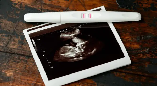 USG pokazuje, jak wygląda płód w 7 tygodniu ciąży. Obok leży pozytywny test ciążowy.