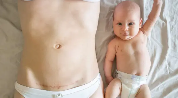 Pierwszy spacer po cesarce. Mama z widoczną blizną na brzuchu i noworodek z podniesioną rączką leżą obok siebie.