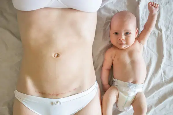 Pierwszy spacer po cesarce. Mama z widoczną blizną na brzuchu i noworodek z podniesioną rączką leżą obok siebie.