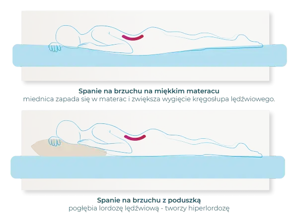 Jak spać po CC: pozycja na brzuchu z poduszką pod biodrami lub na plecach z poduszką pod kolanami.